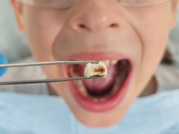 Best Walk-In Emergency Dentist in Nashville, MI